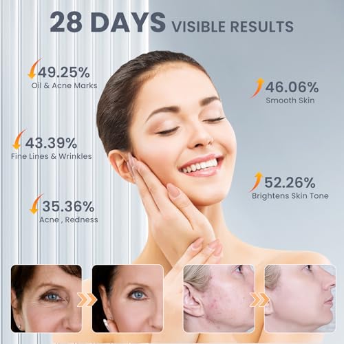 Skin Rejuvenation LED Face Mask: Acne & Fine Lines Reduction - 7 Light Modes - Remote Control - Professional Skincare