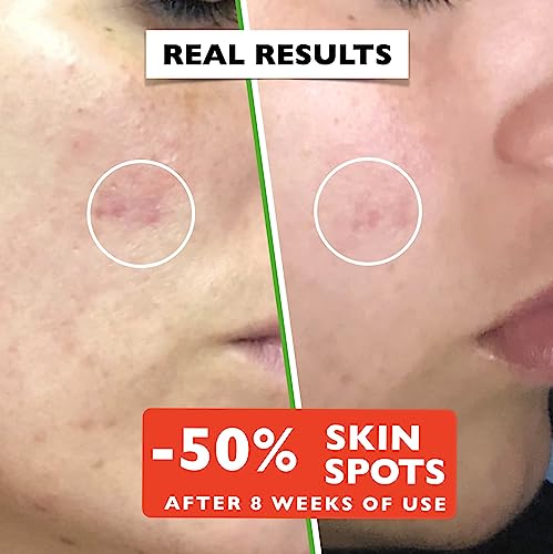 Organic Vitamin C Serum for Face: Anti-Dark Spots, Wrinkles & Hydration. Brightening & Repair.