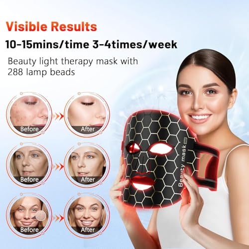 Beauty Reusable LED Light Therapy Facial Mask for Glowing Skin, Anti-Aging & Hydration - 3 Light Modes, Remote Control