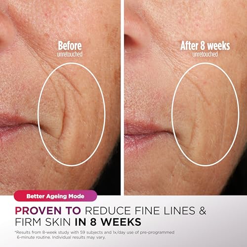 Shark CryoGlow LED Face Mask: Anti-Ageing & Blemish Repair, Red & Blue Light Therapy, USB-C, Remote Control