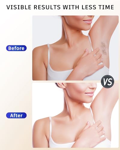 Brand IPL Hair Removal Device: 9 Energy Levels, Painless Ice Cooling, Home Laser for Women Face, Body