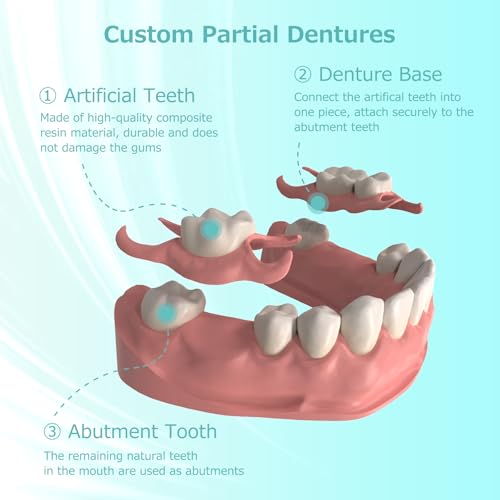 Custom Fit Partial Dentures: Removable Tooth Replacement, Easy to Use, Create Perfect Smile at Home