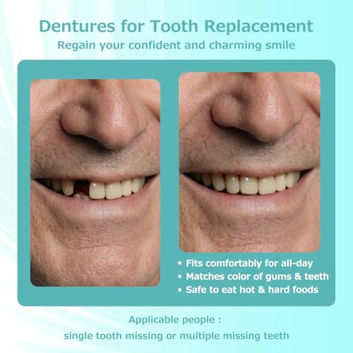 Custom Fit Partial Dentures: Removable Tooth Replacement, Easy to Use, Create Perfect Smile at Home