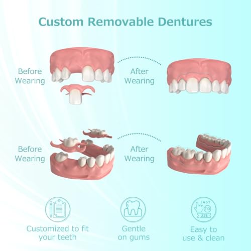 Custom Fit Partial Dentures: Removable Tooth Replacement, Easy to Use, Create Perfect Smile at Home