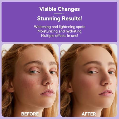 Skin Brightening Serum for Dark Spots on Face & Body - 360° Roller - 20ml