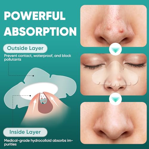 Hydrocolloid Nose Pore Strips - 30 Count, Overnight Oil-Absorbing, Pimple Stickers for Acne Gunk