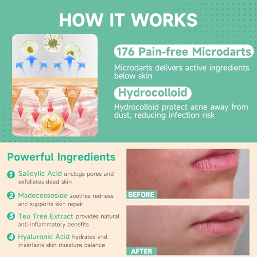 Microdart Acne Patches 36-Count, Salicylic Acid, Madecossoside, Deep Blemishes